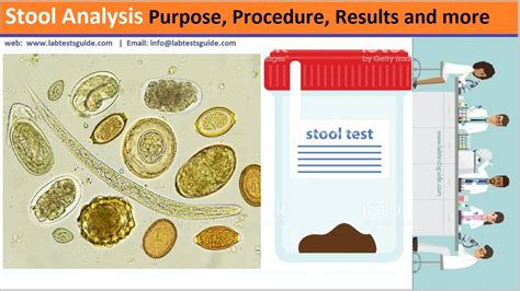 fecalysis|Stool Analysis Test Information.